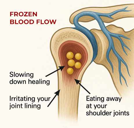 Frozen Blood