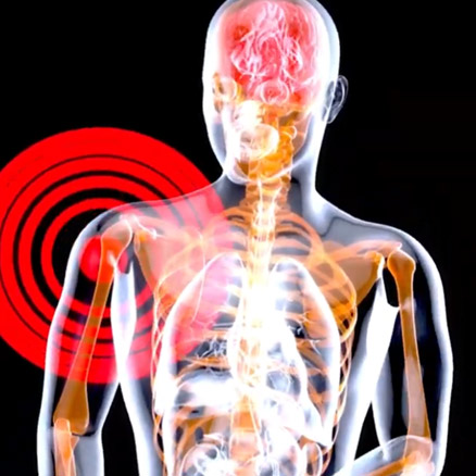 Sharp Pain in Shoulder